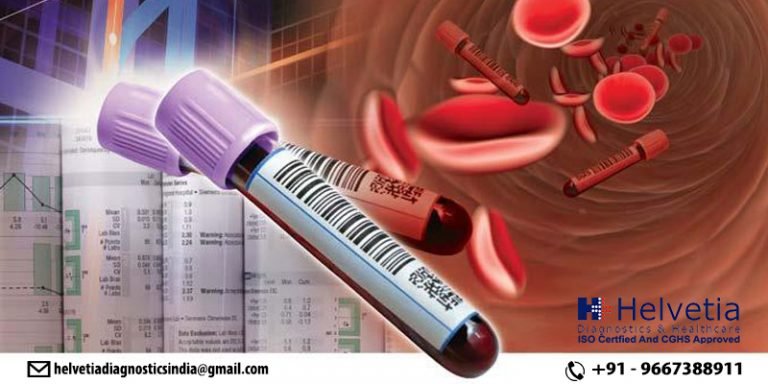 Blood Test Laboratory
