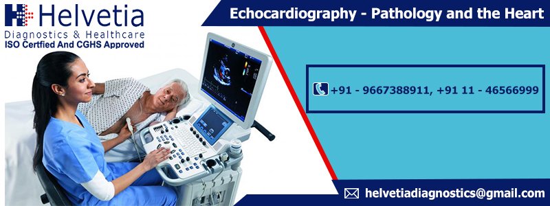 Echocardiography – Pathology and the Heart